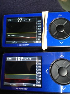 2Dexcom