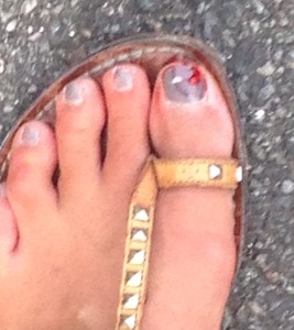 bloody toe